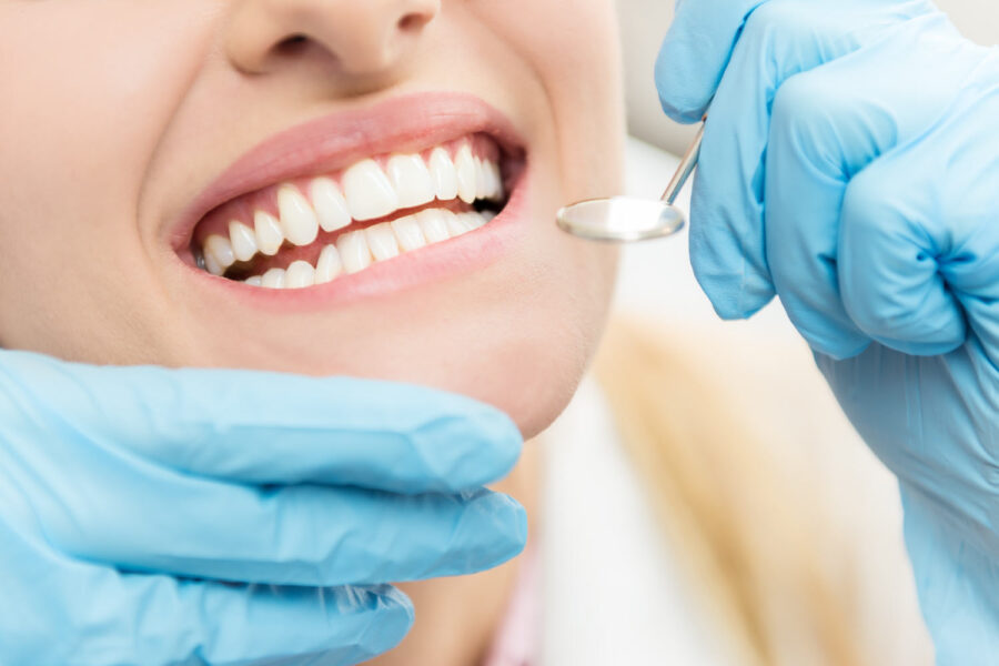 Closeup of a woman smiling as blue gloved hands hold a special dental mirror to examine her teeth during a routine checkup, dentist in bentonville