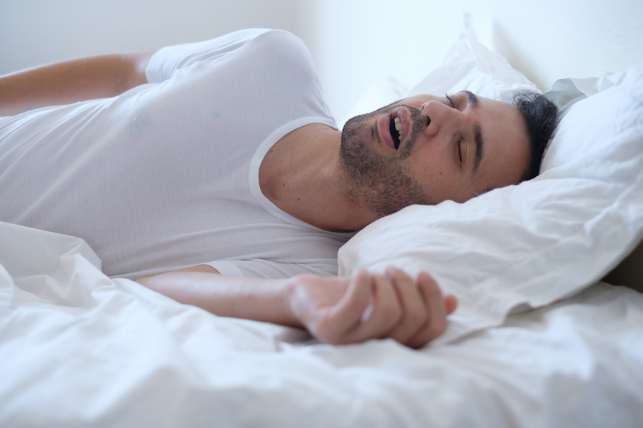 Brunette man with sleep apnea snores with his mouth open in his bed